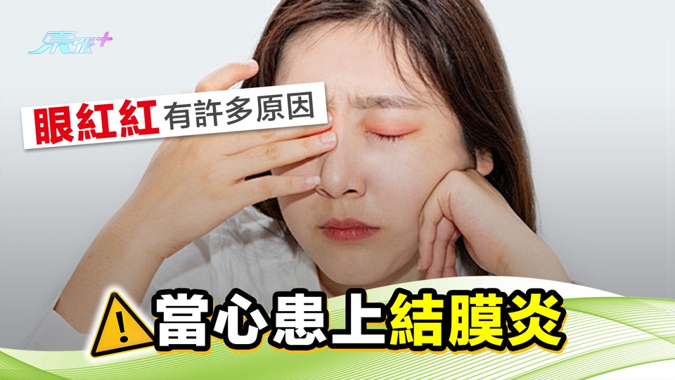「眼紅紅」有許多原因 當心患上結膜炎