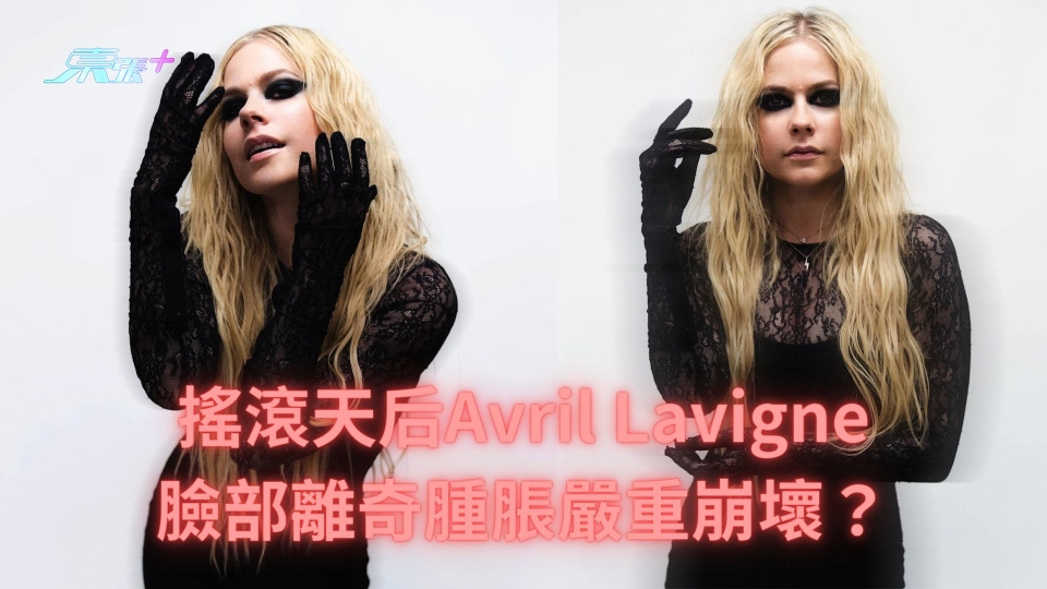 搖滾天后Avril Lavigne臉部離奇腫脹嚴重崩壞？