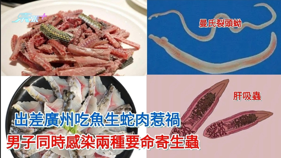 男子出差廣州吃魚生蛇肉惹禍 1個月發燒3次 原來同時感染兩種要命寄生蟲