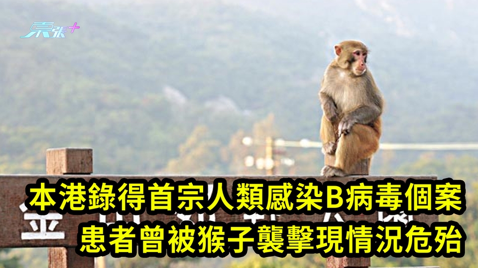 本港錄得首宗人類感染B病毒個案 患者曾被猴子襲擊現情況危殆