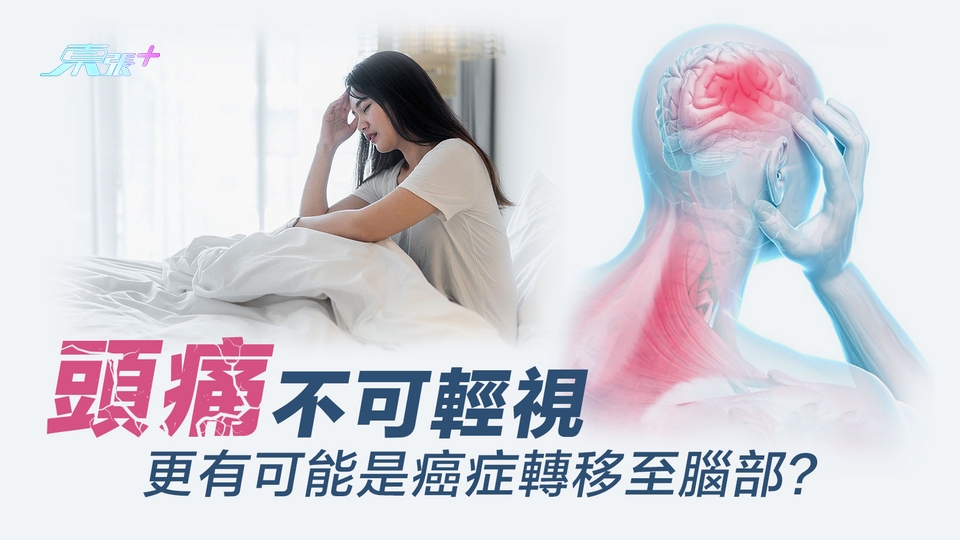 頭痛不可輕視 更有可能是癌症轉移至腦部？