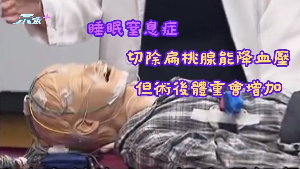 睡眠窒息症｜中大研究：切除扁桃腺能降血壓　但術後體重會增加