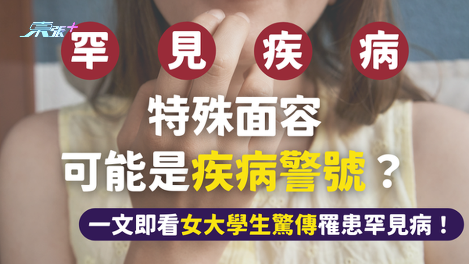 女大學生驚傳罹患罕見病⚠️醫生提醒：尖下巴可能是疾病警號 #至識健康