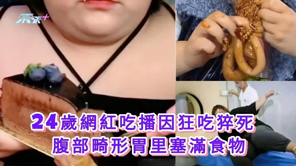 24歲網紅吃播因狂吃猝死 腹部畸形胃里塞滿食物