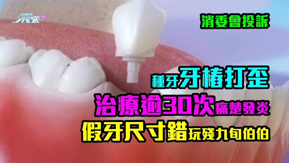 消委會投訴｜種牙牙樁打歪治療逾30次痛楚發炎　假牙尺寸錯玩殘九旬伯伯