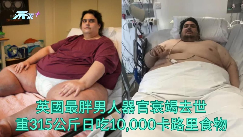 英國最胖男人器官衰竭去世 重315公斤日吃10000卡路里食物